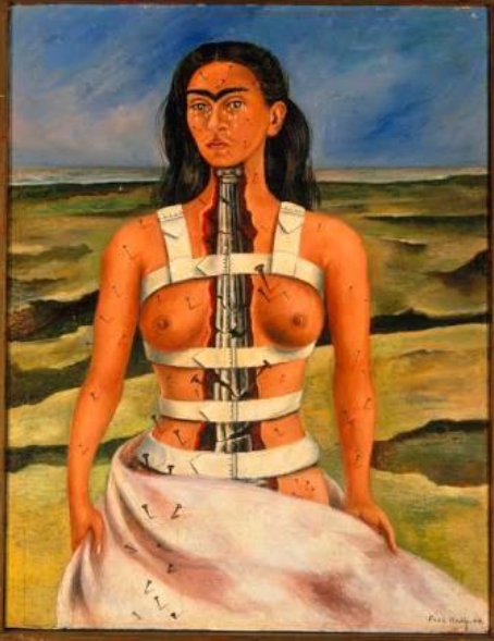 Imagem da obra A coluna partida. Uma mulher está pintada em pá e tem o dorso aberto atravessado por um ferro. 